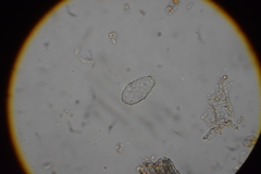Euglypha