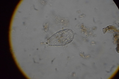 Euglypha strigosa