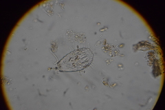 Euglypha strigosa