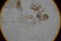 Euglypha strigosa