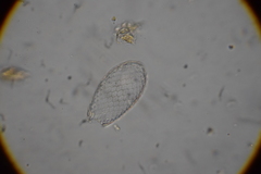 Euglypha rotunda