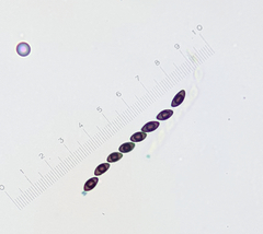 Poronia pileiformis