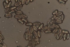 Morchella angusticeps