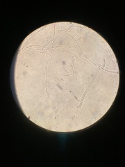 Pulvinula archeri