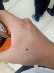 Coleoptera