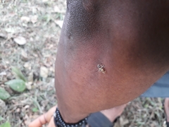 Insecta