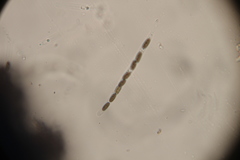 Lopadostoma