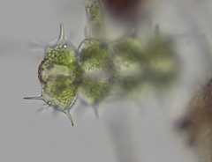 Xanthidium antilopaeum polymazum