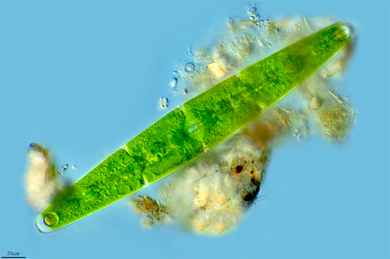 Closterium closterioides