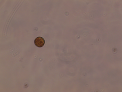 Coscinodiscophycidae