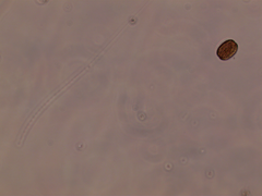 Coscinodiscophycidae