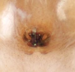 Metaphidippus chera