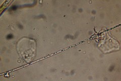 Oscillatoria redekei