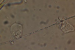 Oscillatoria redekei