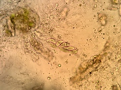 Thelidium pyrenophorum