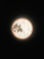 Cronartium conigenum