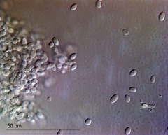 Pseudomicrostroma juglandis