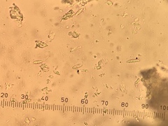 Biatora longispora