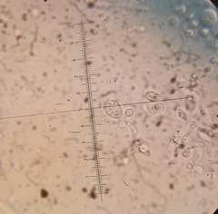 Phaeotremella simplex