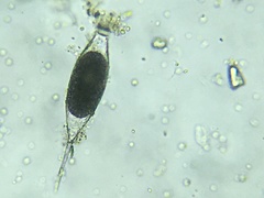 Tintinnopsis