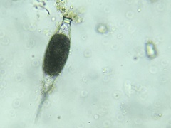 Tintinnopsis