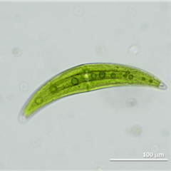 Closterium leibleinii
