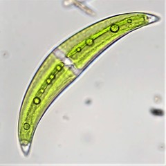 Closterium leibleinii