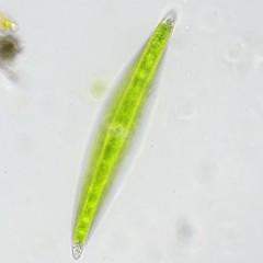 Closterium leibleinii