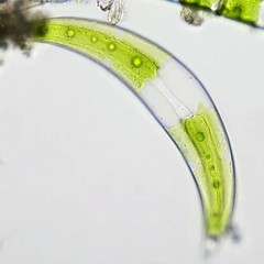 Closterium leibleinii