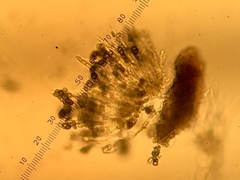 Calicium lenticulare