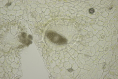 Synchytrium mercurialis