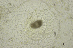 Synchytrium mercurialis