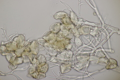 Peronospora hiemalis