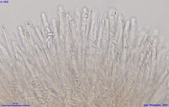 Ciboria betulae