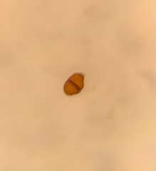 Puccinia aegopodii