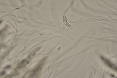 Echinosphaeria canescens