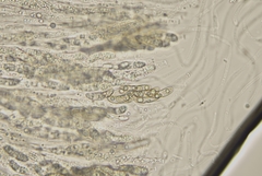 Echinosphaeria canescens