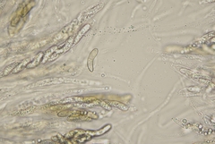 Echinosphaeria canescens