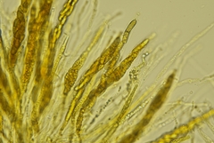 Echinosphaeria canescens