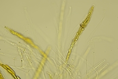 Echinosphaeria canescens
