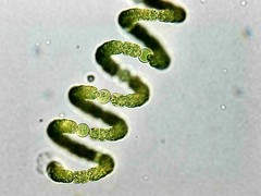 Dolichospermum crassum