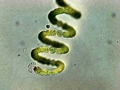 Dolichospermum crassum