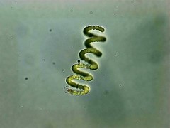 Dolichospermum crassum