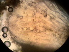 Pertusaria neolecania