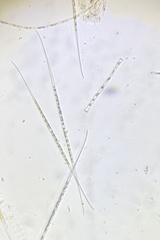 Closterium aciculare
