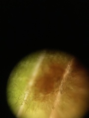 Puccinia thaliae
