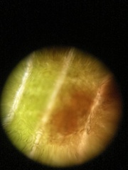 Puccinia thaliae
