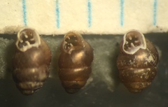 Vertigo oralis
