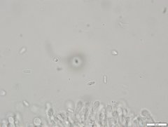 Cartilosoma rene-hentic