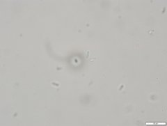 Cartilosoma rene-hentic